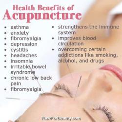 muffintop-less:  The Health Benefits of Acupuncture Avoid and heal so many ailments.  