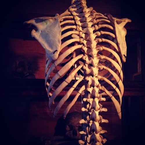 Antique ribcage. Back side. #humanbone #ribcage #antique #humanbone #medicalantique #osteology #bone