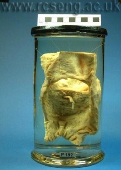 The Bishop’s rectum, in a museum The rectum