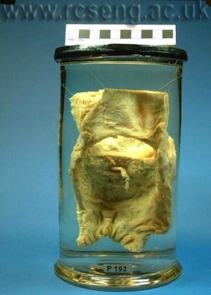 The Bishop’s rectum, in a museum The rectum of the Bishop of Durham sits on display in London. No longer attached to the bishop, it rests alone inside a glass jar in the Hunterian Museum at The Royal College of Surgeons of England. The museum calls