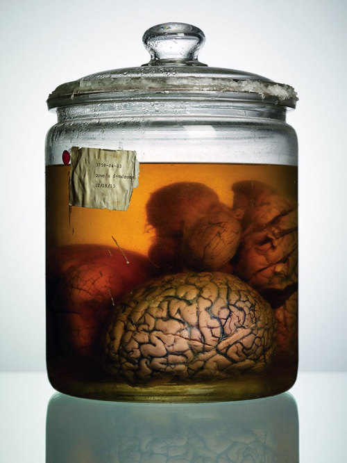 sixpenceee:  Malformed: Forgotten Brains of the Texas State Mental HospitalMalformed, from photographer Adam Voorhees and journalist Alex Hannaford, documents the strange collection of brains in jars taken from mental patients, and documents the unusual