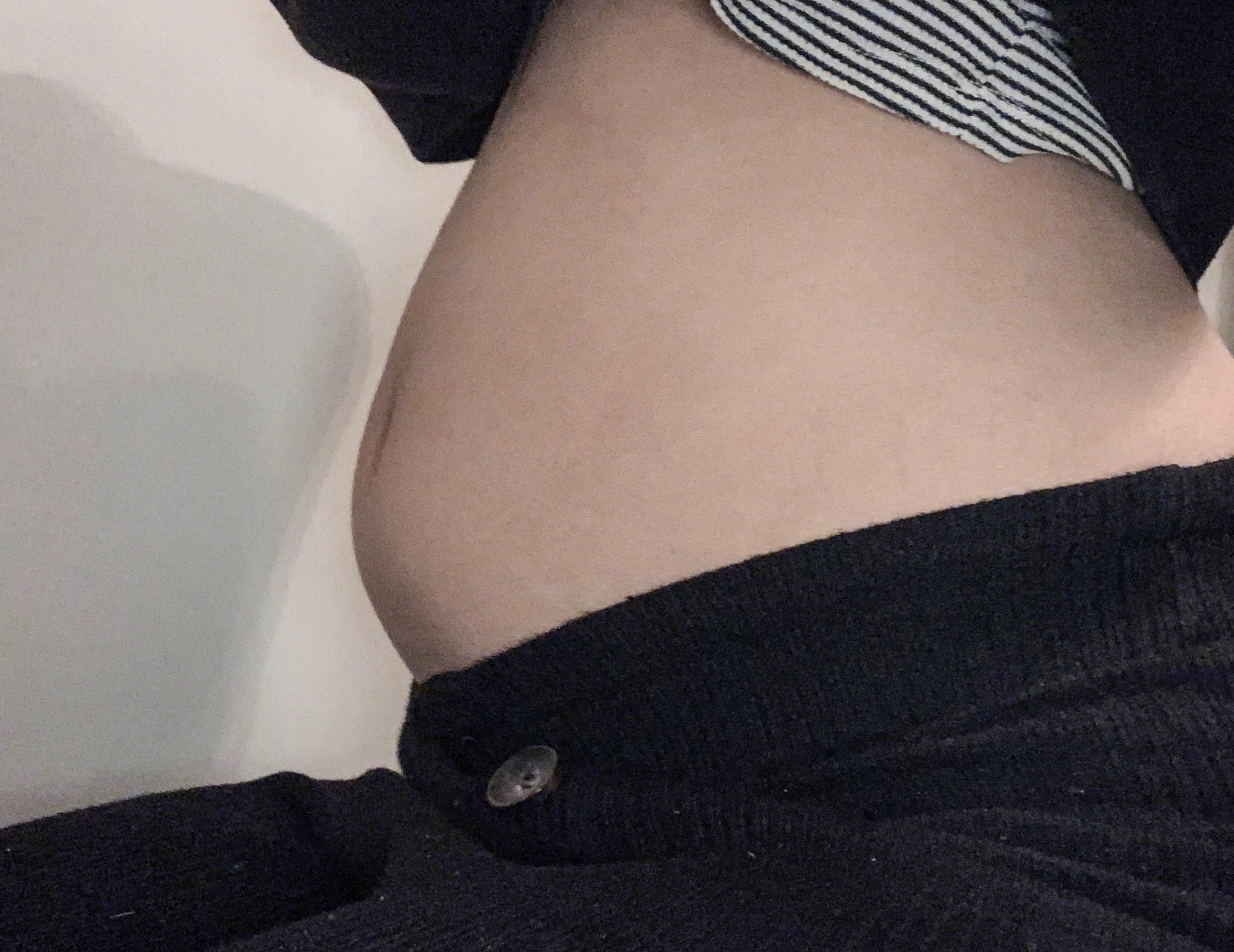 stuffingbelly:Before and after 2 liters of milk 😱