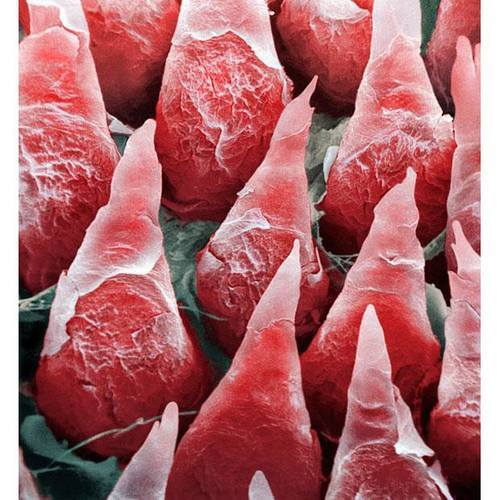 eviscerator:A macro photograph of taste buds on a human tongue.The human tongue has 2,000 - 8,000 ta