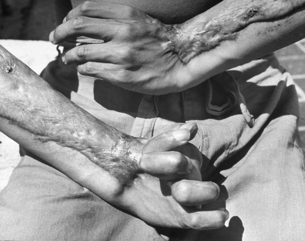 cultureunseen:  Hiroshima and Nagasaki…