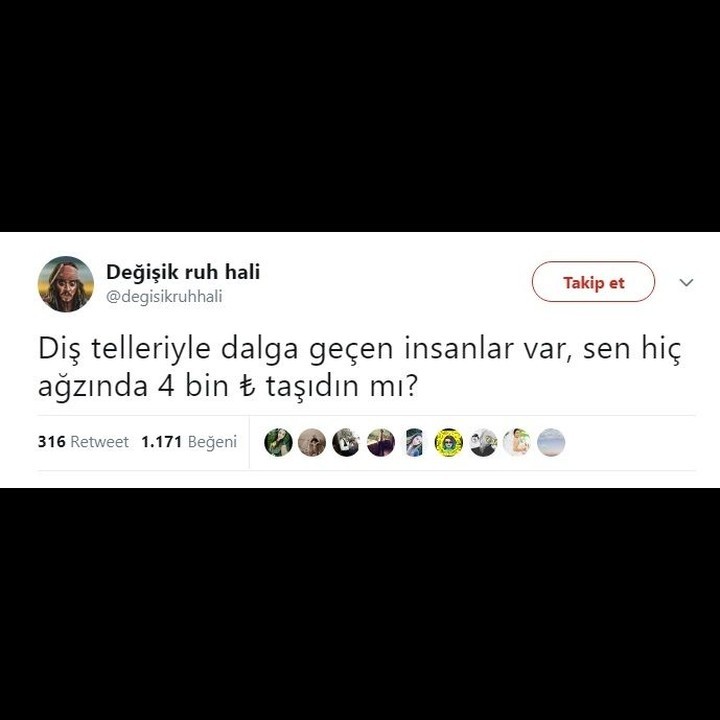 Diş telleriyle dalga geçen...