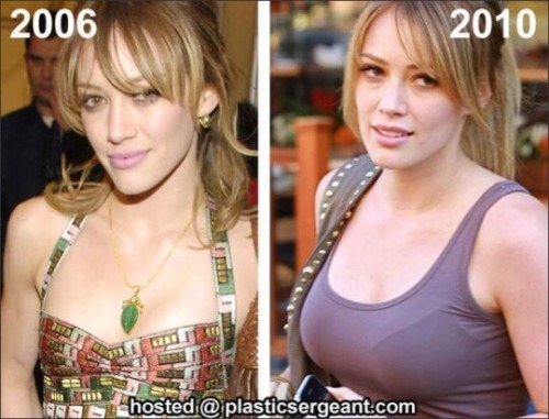 Pregnancy is the most natural form of breast growth. Just look at Hilary Duff, who grew to a 32B after her pregnancy!