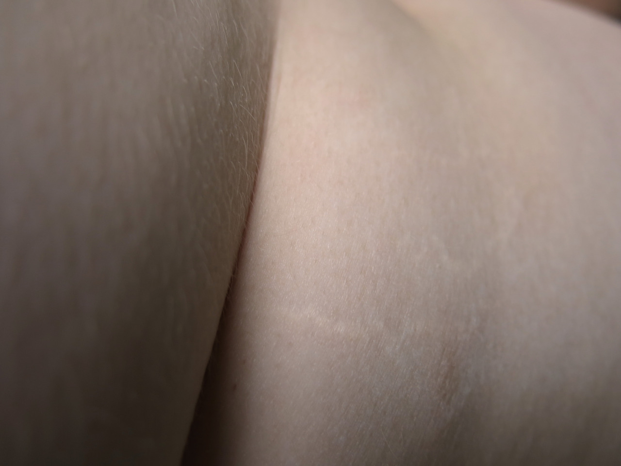 lavie-enrouge:  A homage to my stretch marks. Those that have become transparent