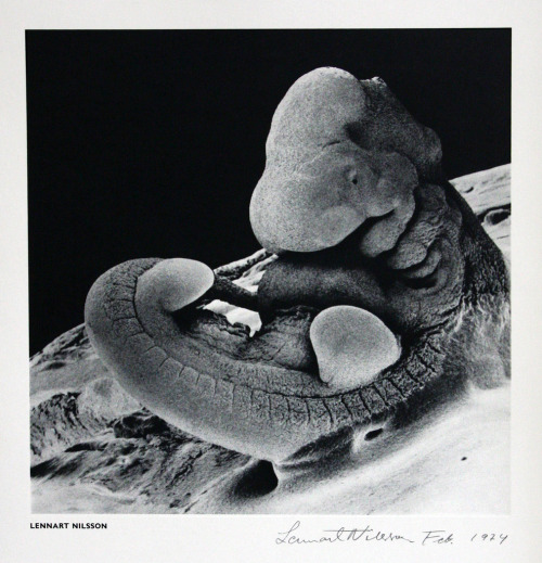 “Lennart Nilsson (born 1922) is a Swedish photographer and scientist. He is noted for his photograph