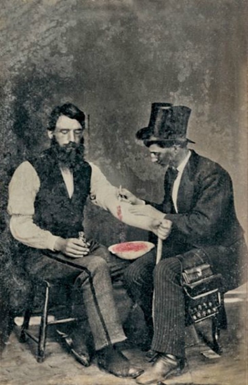 thecivilwarparlor:Bloodletting in 1860, One Of Only Three Known Photographs Of The ProcedureIn eight