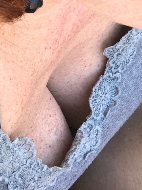 XXX onlyhairywives:Too much sun. Look at my hairy photo