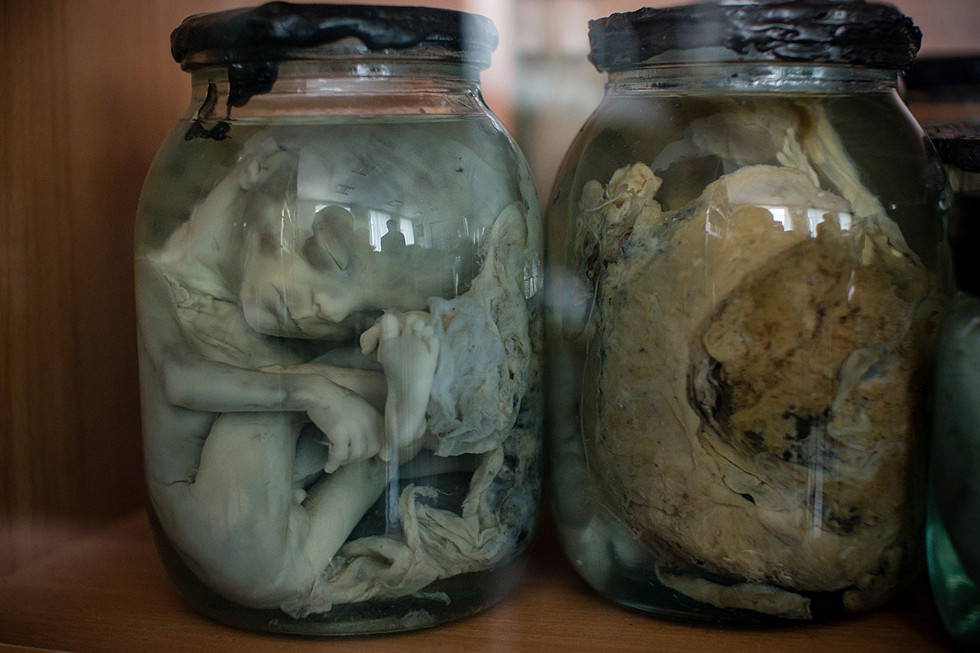 moshita:  an autopsy never lies 
