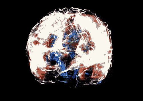 ucresearch:  A whole new meaning to “Deadhead” Above is a representation of former