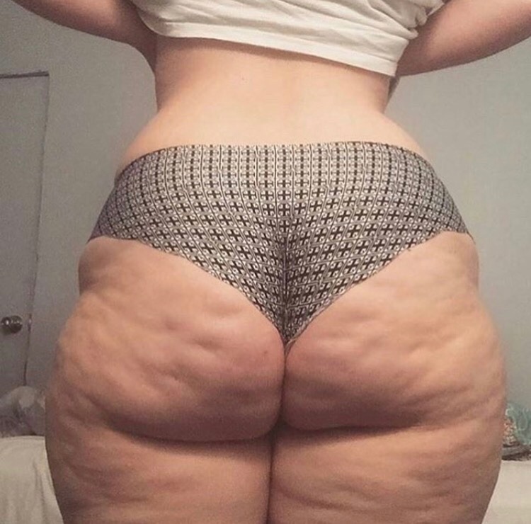 pattmcphatt:  Now that’s Dimply Gorgeous ~ phor 😍😍Show dem dimples ladies