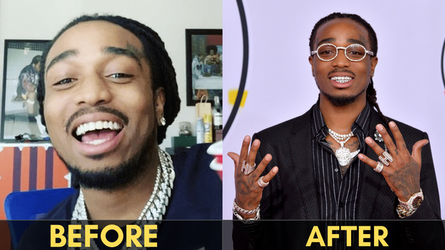 Untitled On Tumblr Quavo s Grill Teeth Worth 250K 