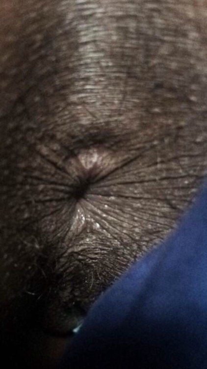 dirtyfantasy69:  My dirty black asshole upclose 👀wanna smell it?