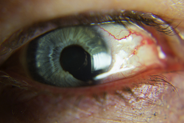 coldemi:  My Mother’s Eye by Nate Bittinger on Flickr.