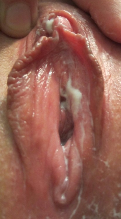 labiacream:  CloseUp       @Labiacream.tumblr.com Submit Creampie pics (44,000  Followers) 