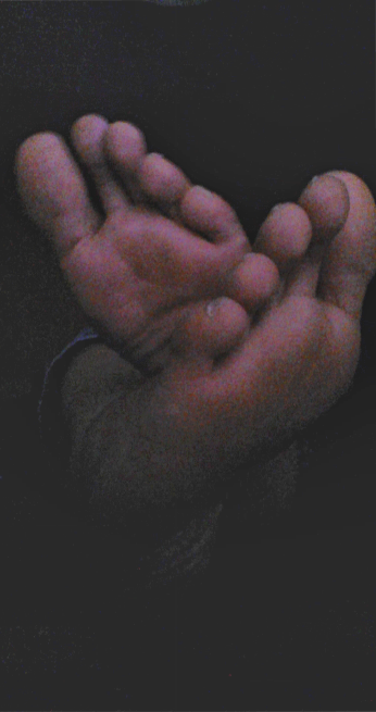 g-feet20:  An old set of photos I took with a webcam a while back. Sorry about the