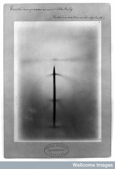 X-rays by Roentgen. Wire coil; piece of tinfoil; zinc; leaden cage, 1895.