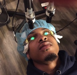 alsinanation:  So I have this eye disease.. Blind in my left, and losing vision in my right. In order to prevent my eyesight from deteriorating ihad to do this surgery. This shit is beyond painful &amp; Life be throwin’ a nigxa curve balls but what