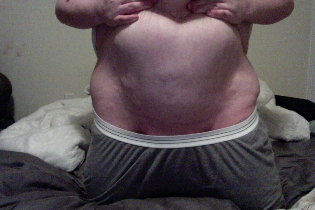 chubbytogepi:  My first photoset. Enjoy  Love that double belly