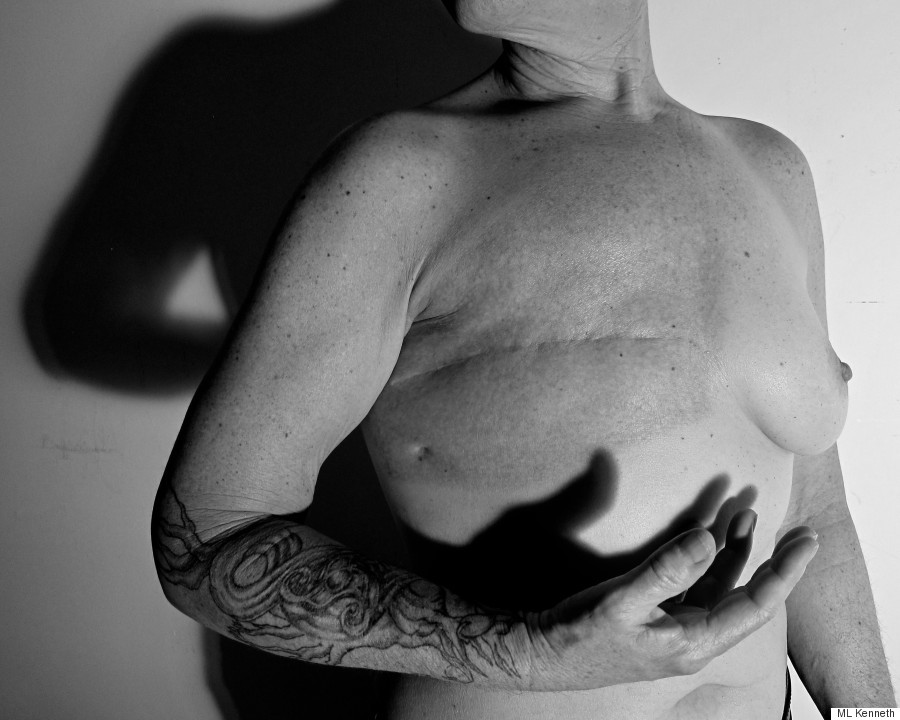 huffingtonpost:  Stunning ‘Woman: Redefined’ Portraits Show How Breast Cancer