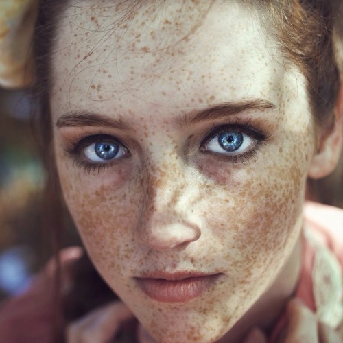 anectar:nice ginger! ! !