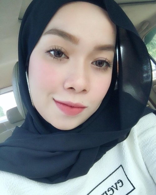 adamzack21: Rea Kool FM. Braces