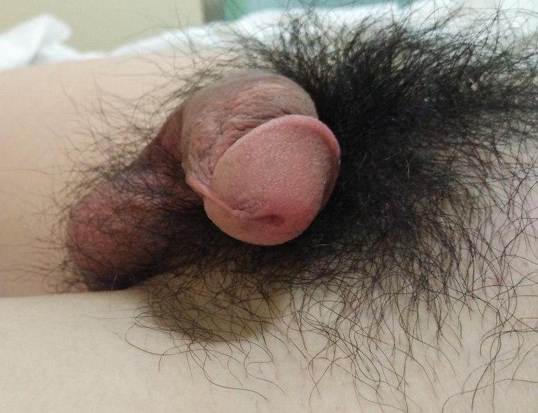 zlam333:  수면