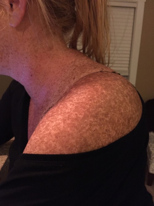 sarahthomasasu: Got some sun today! Even managed some tan lines which is not easy for me!  Schö