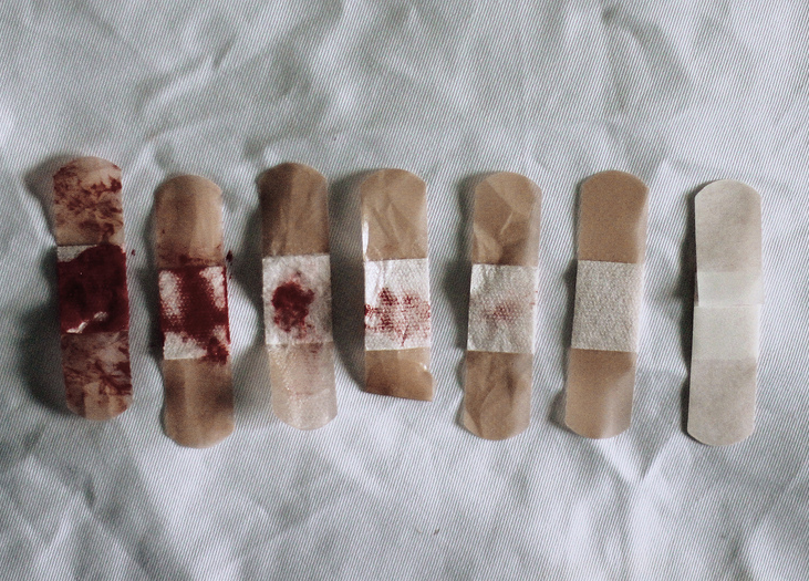 melisica:Healing Process, Alyssa Zoé Amaro