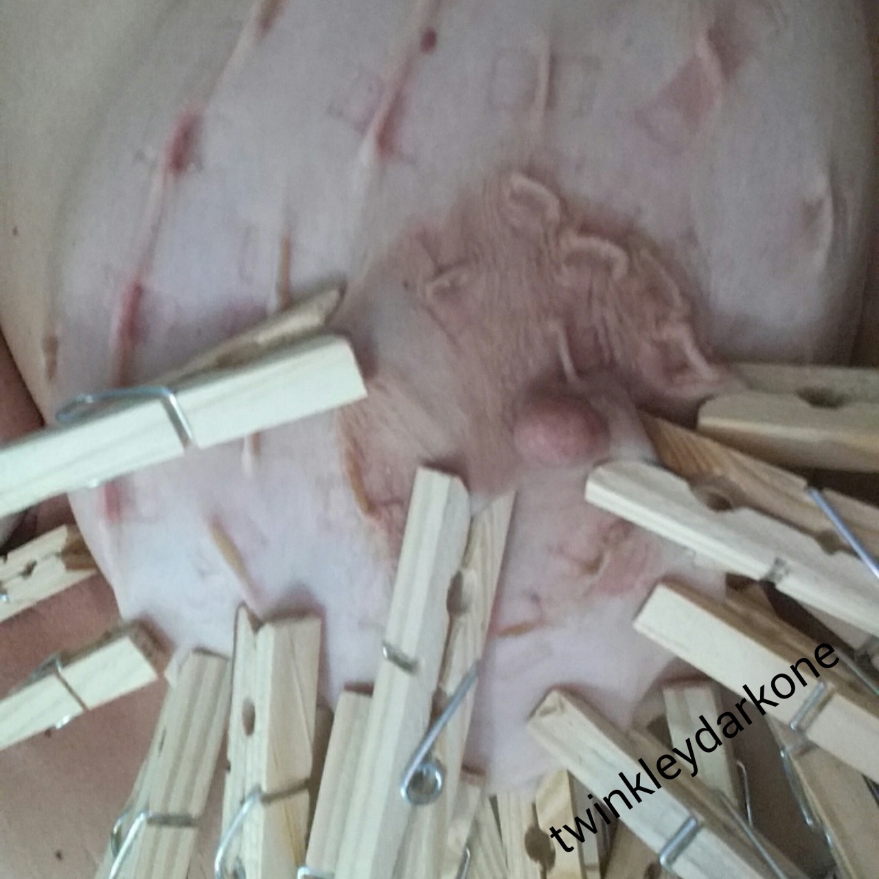 twinkleydarkone:  Removal of 50 clothespins.