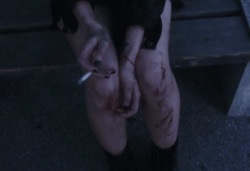 Every-Bruise:  . Em We Heart It. 