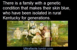 bookgumps:  ultrafacts:  Source For more posts like this, follow Ultrafacts  I’m (distantly) related to these people! This is the Fugate family and the blue skin is caused by something (I can’t remember if it’s a special pigment in the skin or something