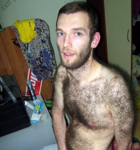 Furry Necks