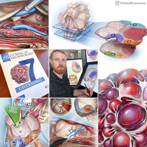 Art vs Artist thing…It’s been the year of cavernomas ✍‍#artvsartist #medicalbook #t