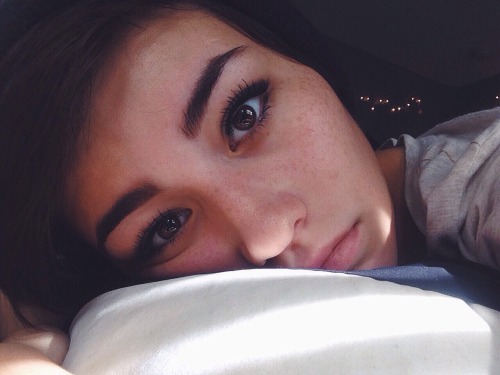 auburnbrown:my freckles look so dark 