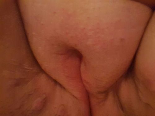 Porn rdnkchk311:Fat pussy so yummy and juicy photos
