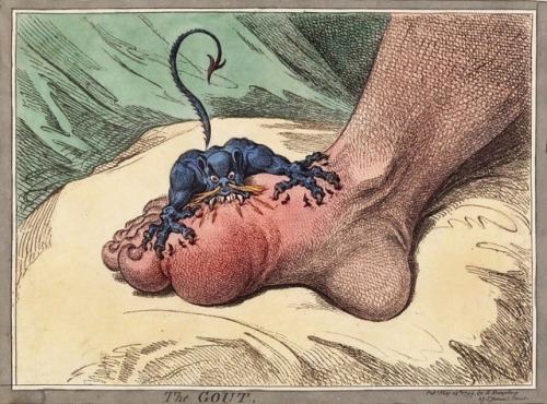 The Gout (1799), by British cartoonist, James Gillray.
