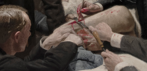 Thomas Eakins, Details from Portrait of Dr. Samuel D. Gross (The Gross Clinic) (1875), Phi