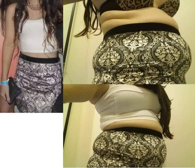 the-elefant-in-the-room:  Then and now, 20kg difference. Skirt doesn’t do up at