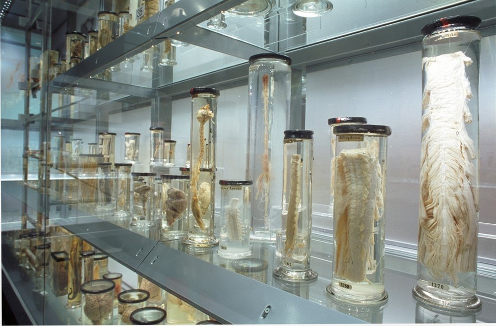 sixpenceee:  The Hunterian Museum in London houses a fascinating collection of human
