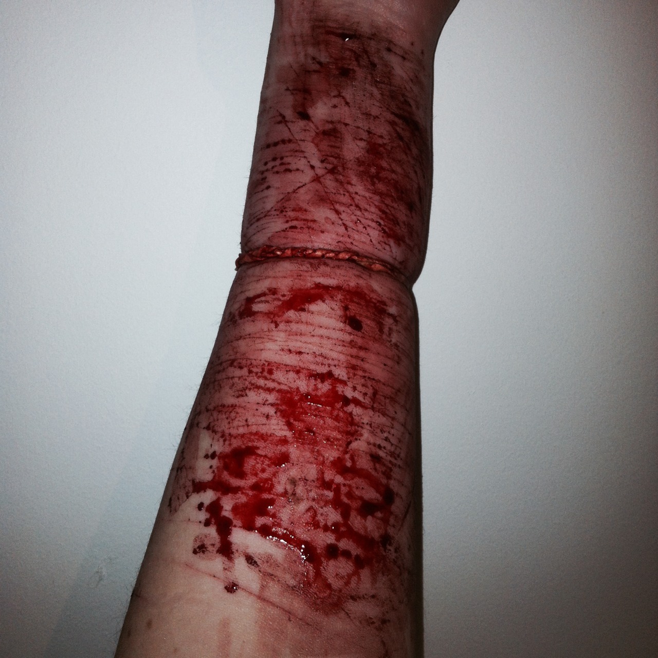 canttakethepainanylonger:  What’s wrong with me 
