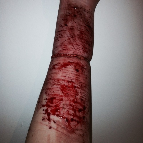 canttakethepainanylonger:  What’s wrong with me 