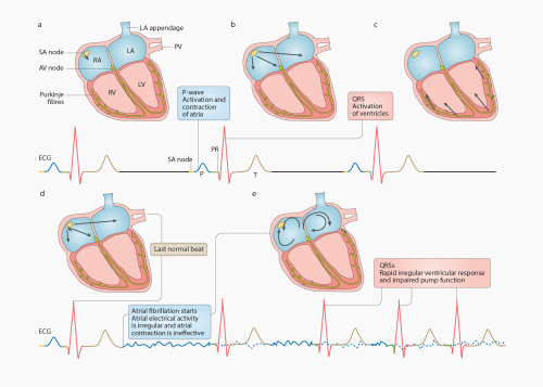 designinbiology - Electrical conduction during sinus rhythm and...