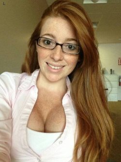 babes-with-glasses:  Freckles