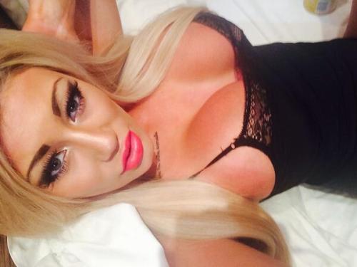 amateur-implant-pics:  DalzellSophie