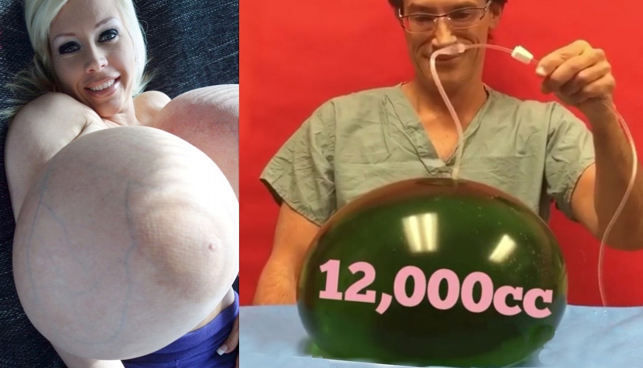crashbimbofication:  If your implants are this big, then maybe, *possibly*, we could
