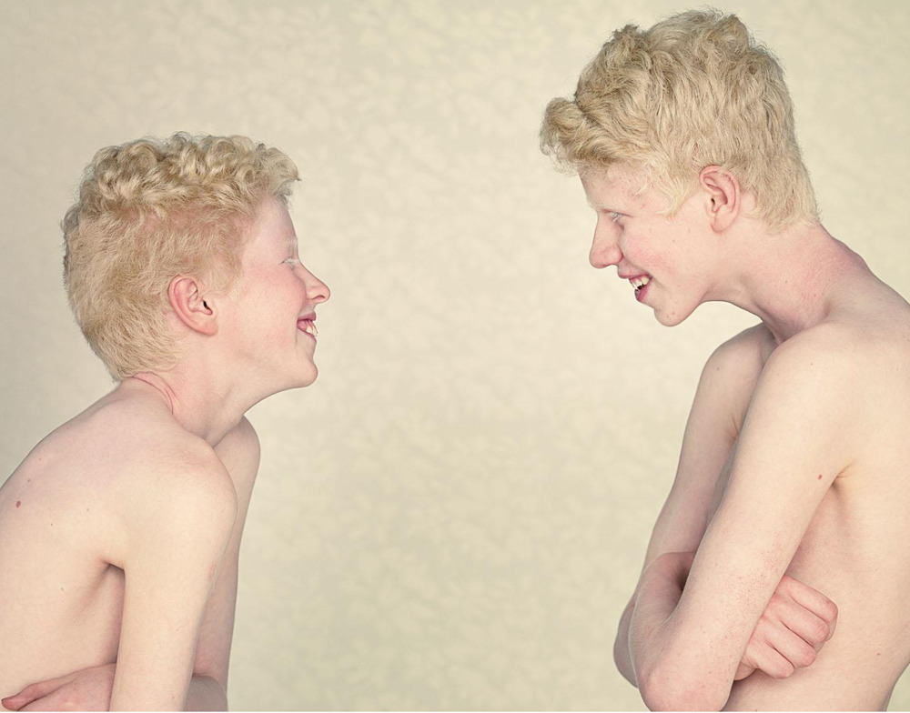 jareth-gates:  likeafieldmouse: Gustavo Lacerda - Albinos (2009-12) 