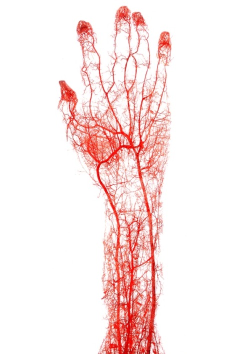 Gunther von Hagens - Acid-Corrosion Cast Of The Arteries Of  The Adult Human Hand And Forearm